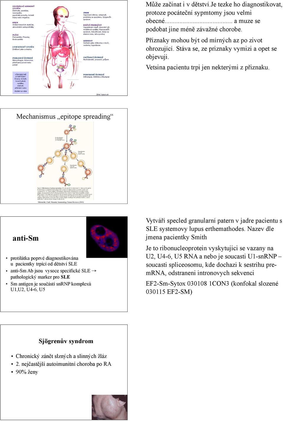 Mechanismus epitope spreading Shlomchik, Craft, Mamula; Immunology Nature Reviews (2001) anti-sm protilátka poprvé diagnostikována u pacientky trpící od d#tství SLE anti-sm Ab jsou vysoce specifické