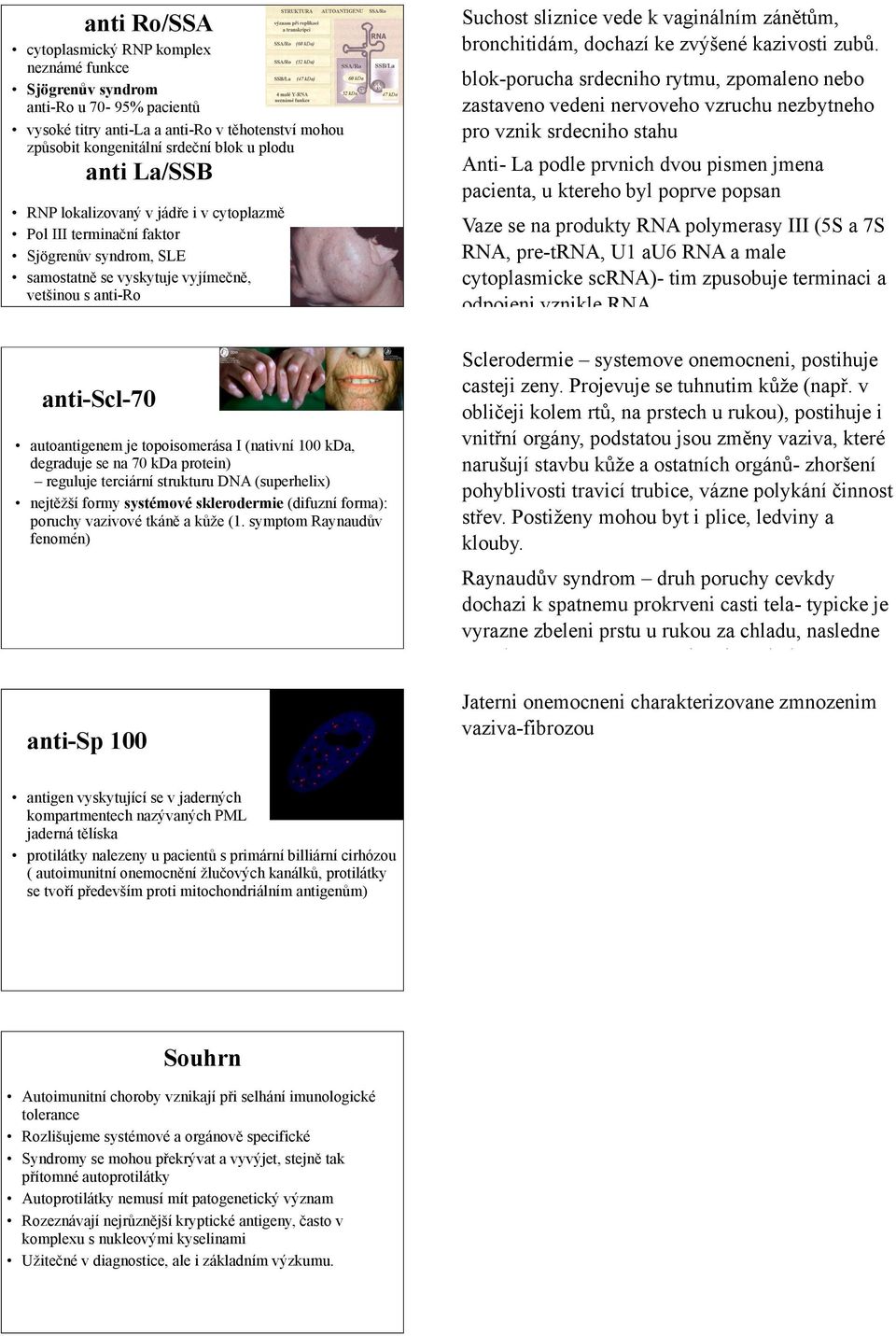 v jád%e i v cytoplazm# Pol III termina'ní faktor Sjögren(v syndrom, SLE samostatn# se vyskytuje vyjíme'n#, vet"inou s anti-ro anti-scl-70 autoantigenem je topoisomerása I (nativní 100 kda, degraduje