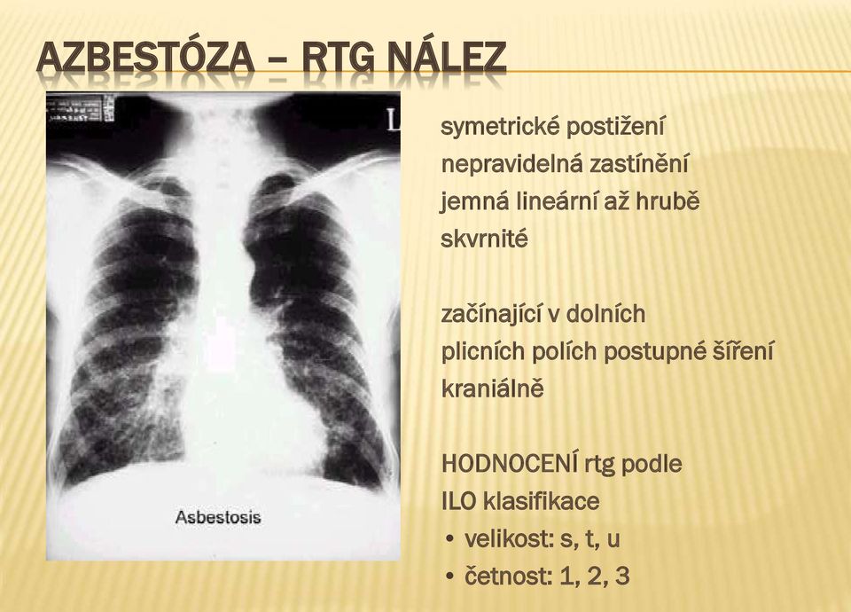 dolních plicních polích postupné šíření kraniálně