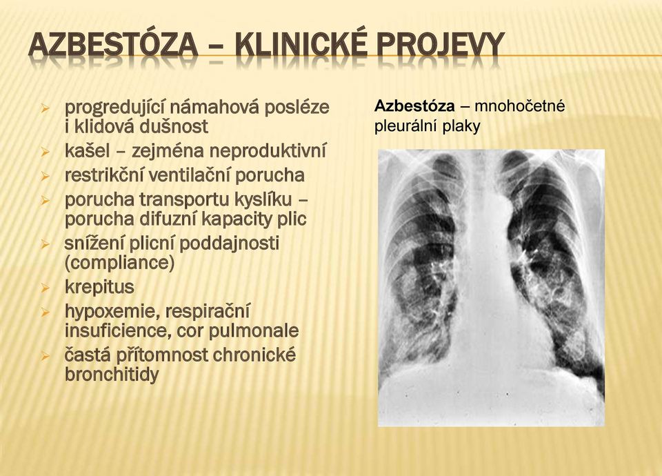 kapacity plic snížení plicní poddajnosti (compliance) krepitus hypoxemie, respirační