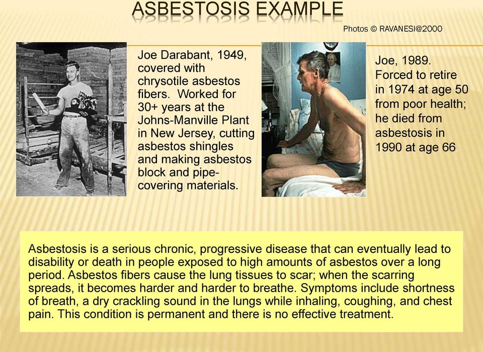 Forced to retire in 1974 at age 50 from poor health; he died from asbestosis in 1990 at age 66.