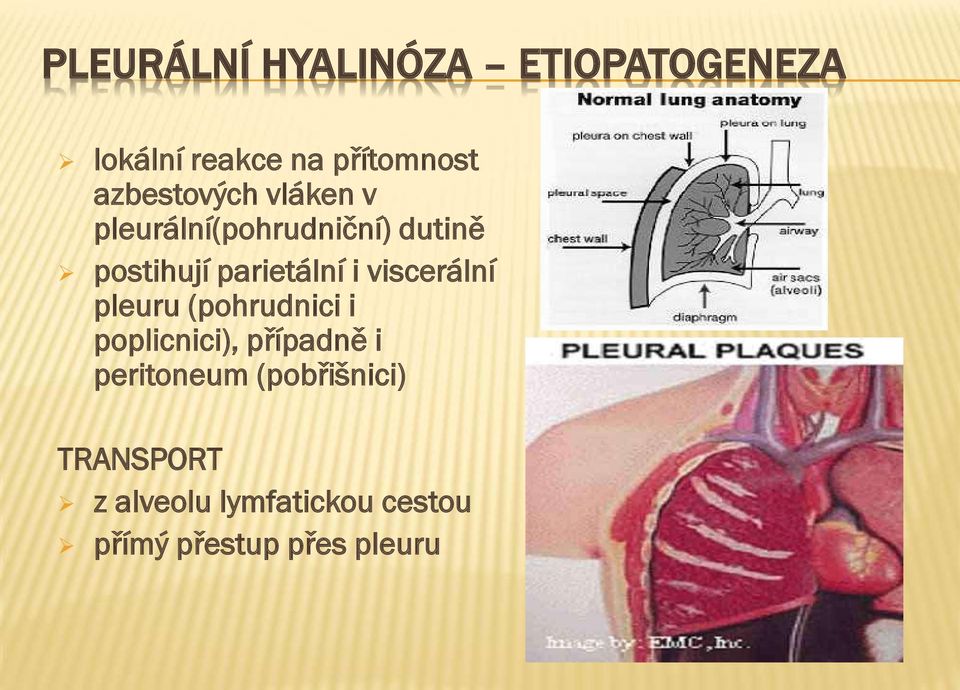 parietální i viscerální pleuru (pohrudnici i poplicnici), případně i