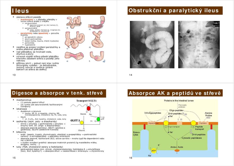 pankreatitida bolest (kolika, trauma, infarkt myokardu) peritonitida hypokalemie nejdříve se projeví zvýšení peristaltiky a snaha překonat překážku nad překážkou se hromadí voda, chymus a plyny