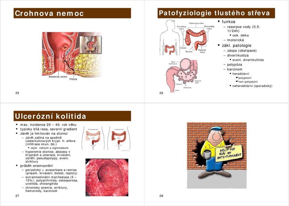 rok věku typicky bílá rasa, severní gradient zánět je limitován na sliznici zánět začíná na spodině Lieberkuhnových krypt. tl. střeva (infiltrace imun. bb.) zejm.