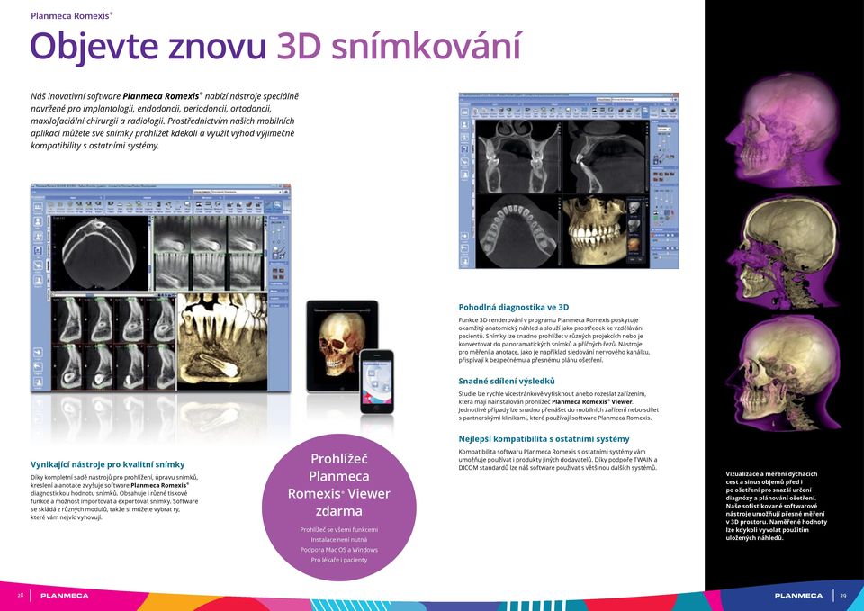 Pohodlná diagnostika ve 3D Funkce 3D renderování v programu Planmeca Romexis poskytuje okamžitý anatomický náhled a slouží jako prostředek ke vzdělávání pacientů.