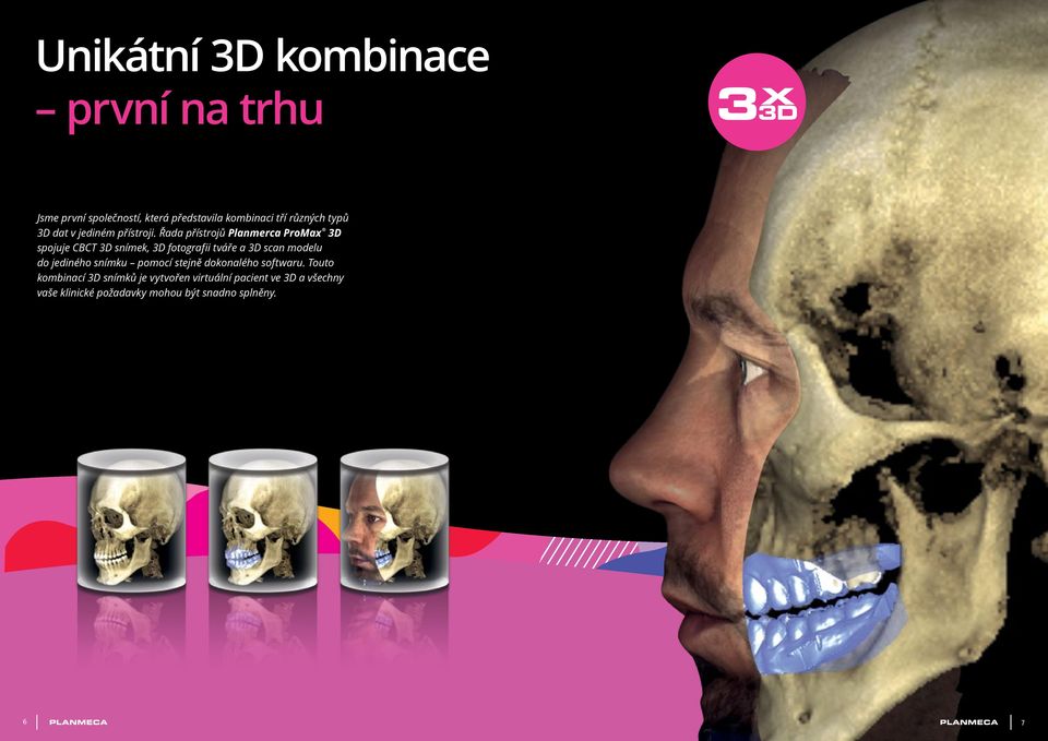 Řada přístrojů Planmerca ProMax 3D spojuje CBCT 3D snímek, 3D fotografii tváře a 3D scan modelu do