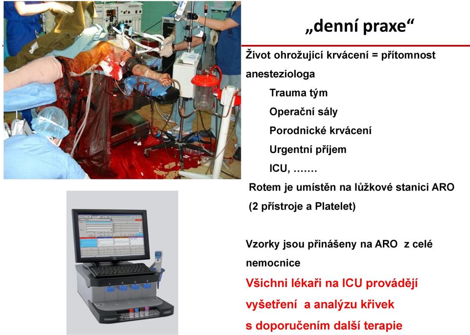 Rotem je umístěn na lůžkové stanici ARO (2 přístroje a Platelet) Vzorky jsou