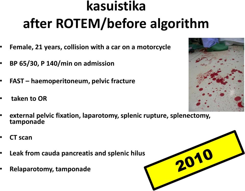 fracture taken to OR external pelvic fixation, laparotomy, splenic rupture,