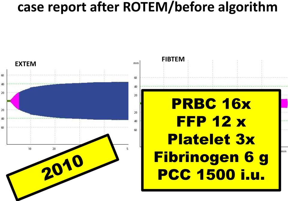 EXTEM FIBTEM PRBC 16x FFP
