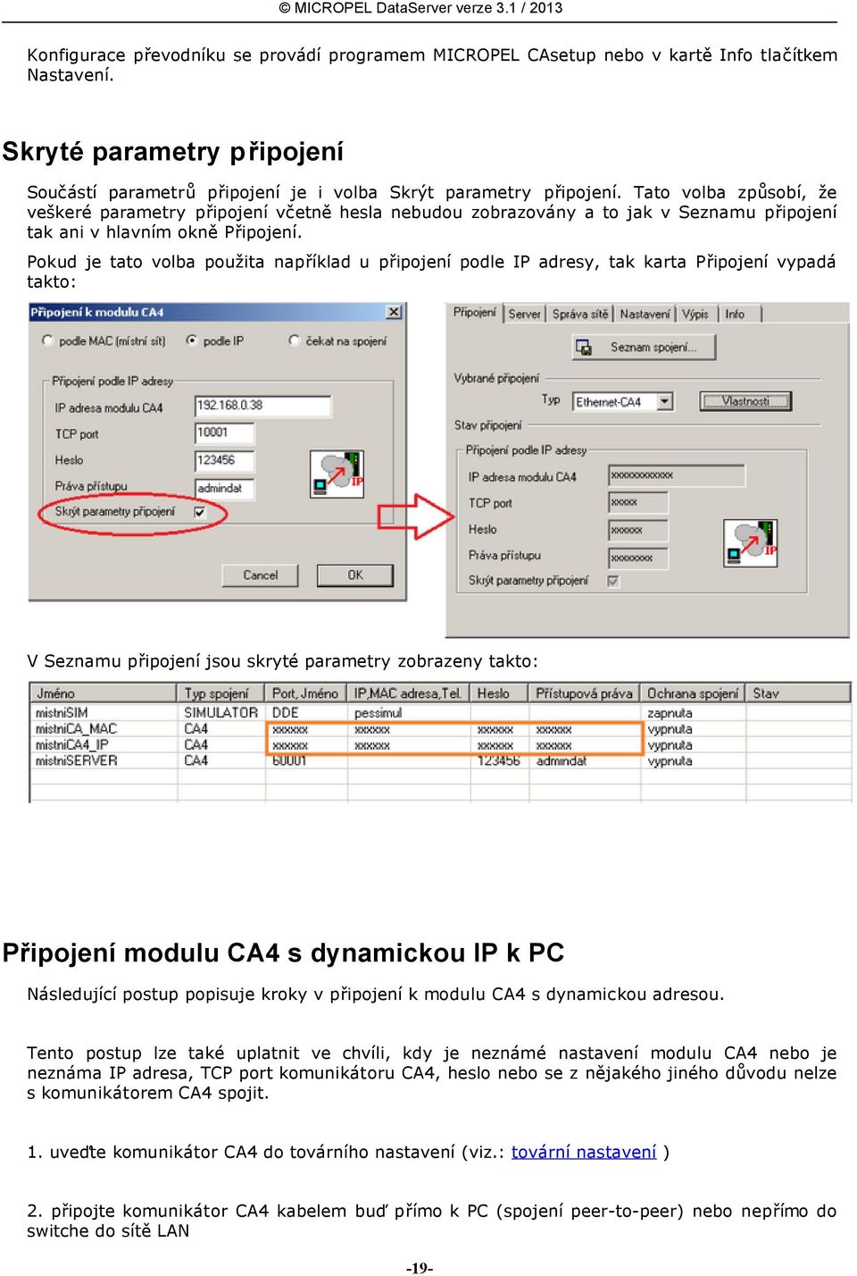 Pokud je tato volba použita například u připojení podle IP adresy, tak karta Připojení vypadá takto: V Seznamu připojení jsou skryté parametry zobrazeny takto: Připojení modulu CA4 s dynamickou IP k