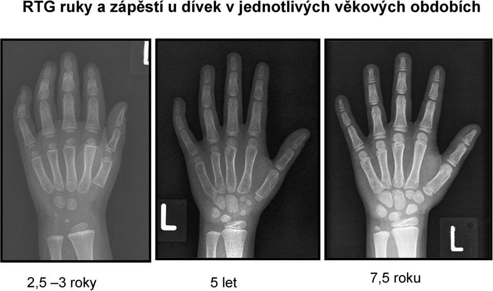 věkových obdobích 2,5