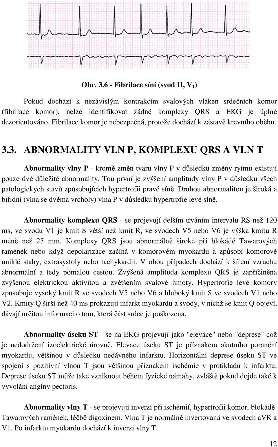 Fibrilace komor je nebezpečná, protože dochází k zástavě krevního oběhu. 3.