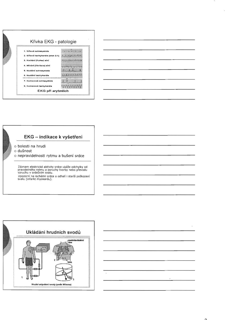 elektrické aktivity srdce ukáže odchylky od pravidelného rytmu a poruchy tvorby nebo prevodu vzruchu v srdečním svalu.