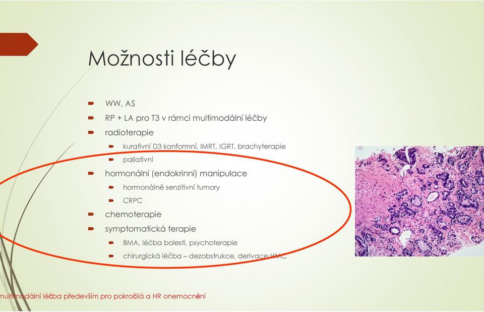 senzitivní tumory CRPC chemoterapie symptomatická terapie BMA, léčba bolesti, psychoterapie