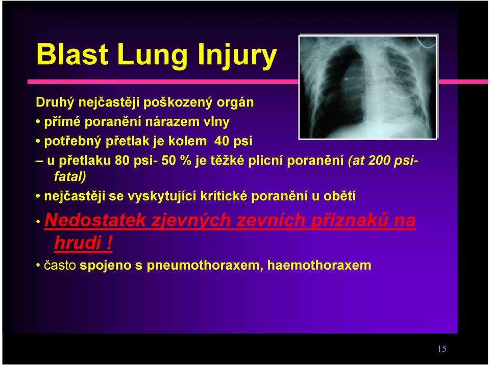 (at 200 psifatal) nejčastěji se vyskytující kritické poranění u obětí Nedostatek