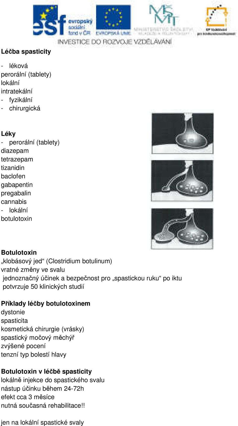 iktu potvrzuje 50 klinických studií Příklady léčby botulotoxinem dystonie spasticita kosmetická chirurgie (vrásky) spastický močový měchýř zvýšené pocení tenzní typ bolestí