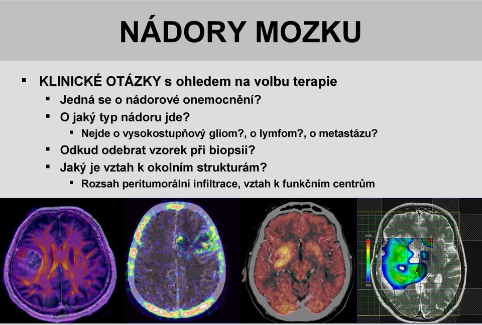 , o lymfom?, o metastázu? Odkud odebrat vzorek při biopsii?