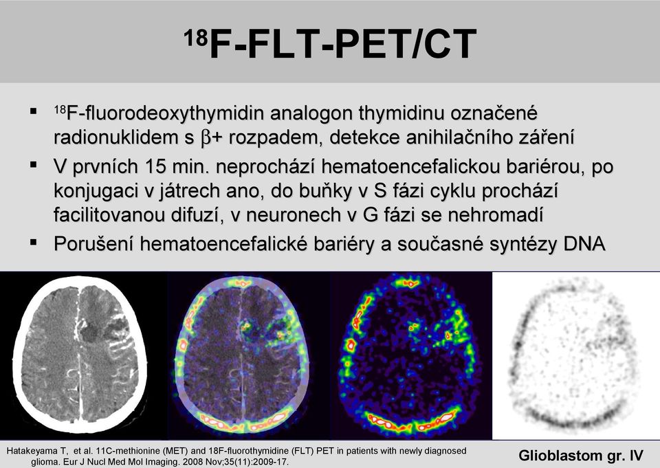 neuronech v G fázi se nehromadí Porušení hematoencefalické bariéry a současné syntézy DNA 18 Hatakeyama T, et al.