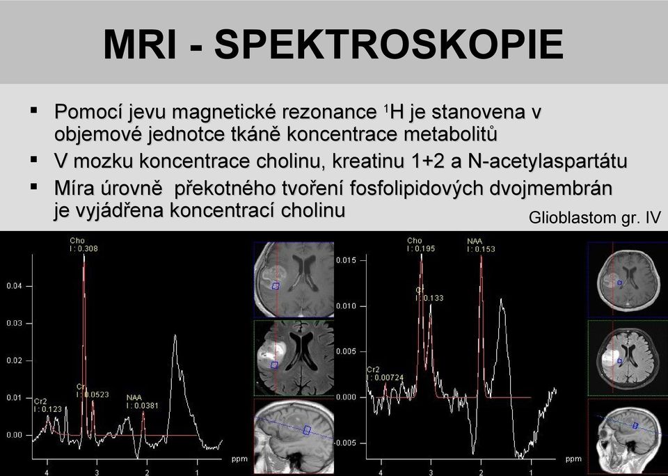 cholinu, kreatinu 1+2 a N-acetylaspartátu Míra úrovně překotného tvoření