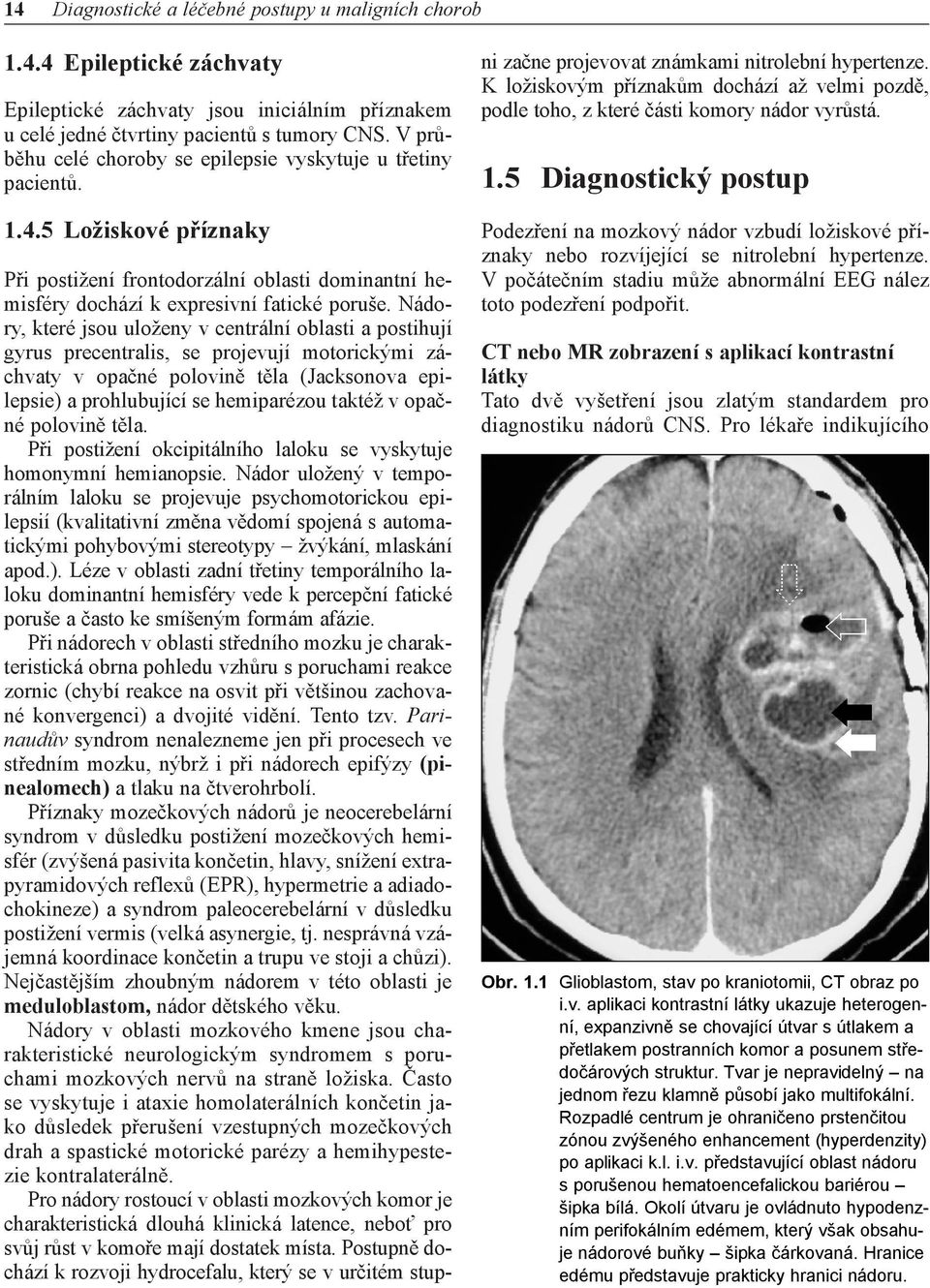 Nádory, které jsou uloženy v centrální oblasti a postihují gyrus precentralis, se projevují motorickými záchvaty v opačné polovině těla (Jacksonova epilepsie) a prohlubující se hemiparézou taktéž v