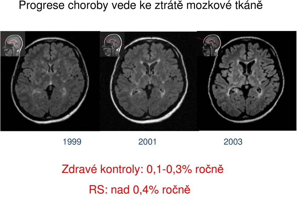 2001 2003 Zdravé kontroly: