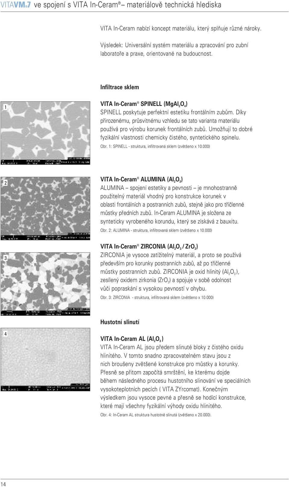 Infiltrace sklem VITA In-Ceram SPINELL (MgAl 2 O 4 ) SPINELL poskytuje perfektní estetiku frontálním zubům.