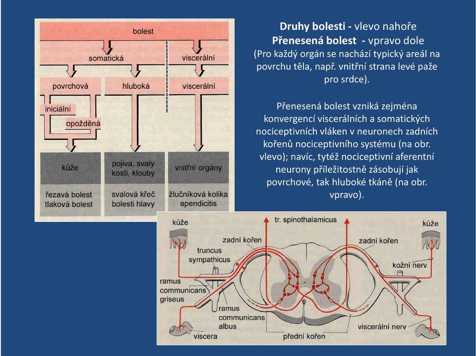 Přenesená bolest vzniká zejména konvergencí viscerálních a somatických nociceptivních vláken v neuronech