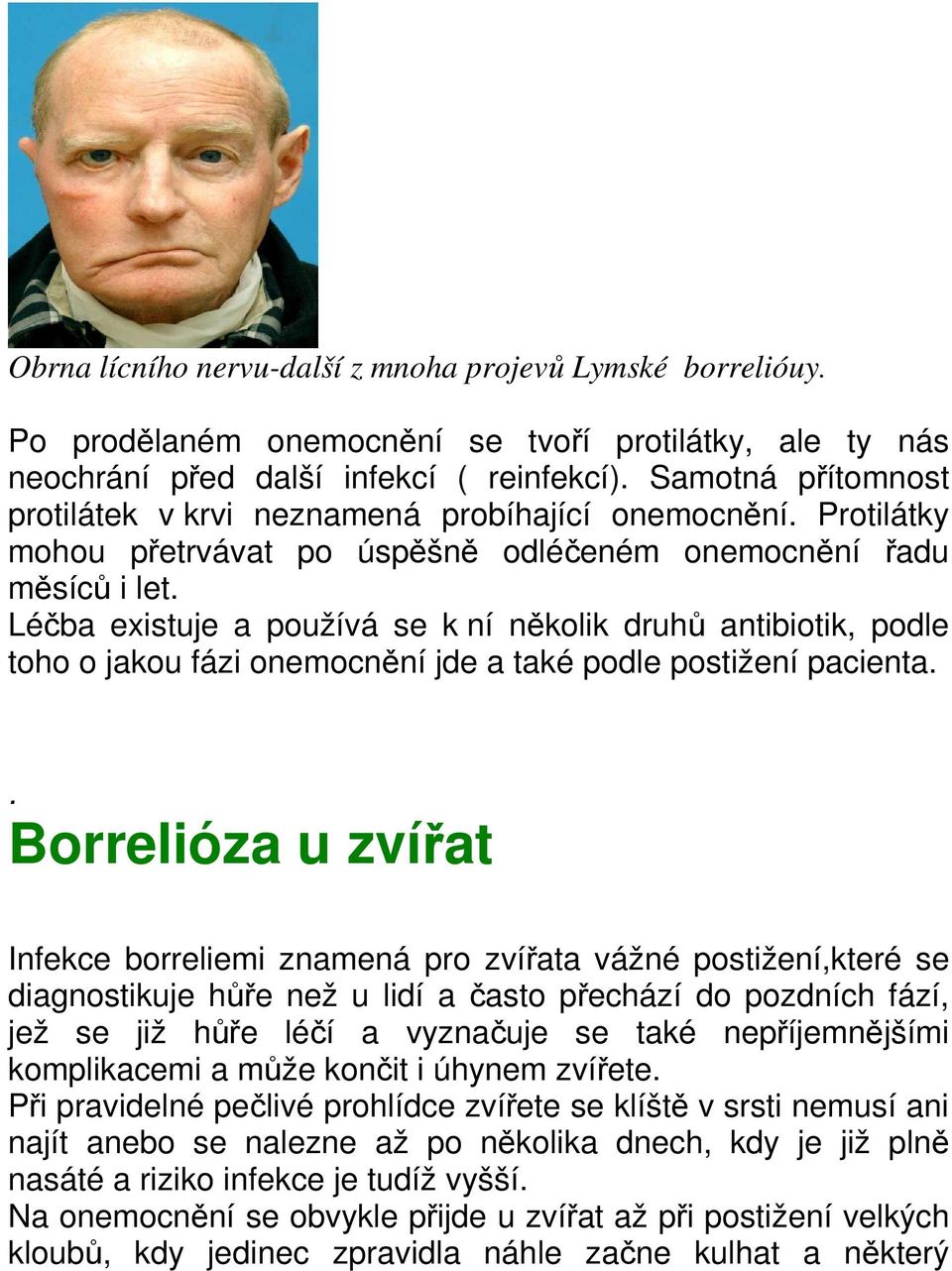 Léčba existuje a používá se k ní několik druhů antibiotik, podle toho o jakou fázi onemocnění jde a také podle postižení pacienta.