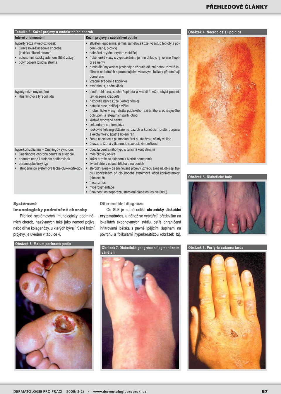 polynodózní toxická struma hypotyreóza (myxedém) Hashimotova tyreoiditida hyperkortizolizmus Cushingův syndrom: Cushingova choroba centrální etiologie adenom nebo karcinom nadledvinek