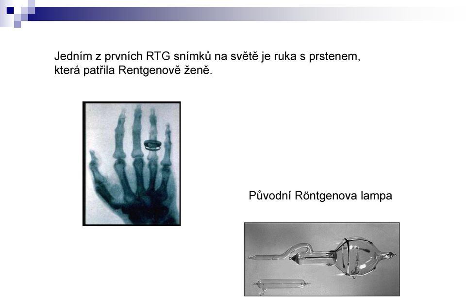 prstenem, která patřila