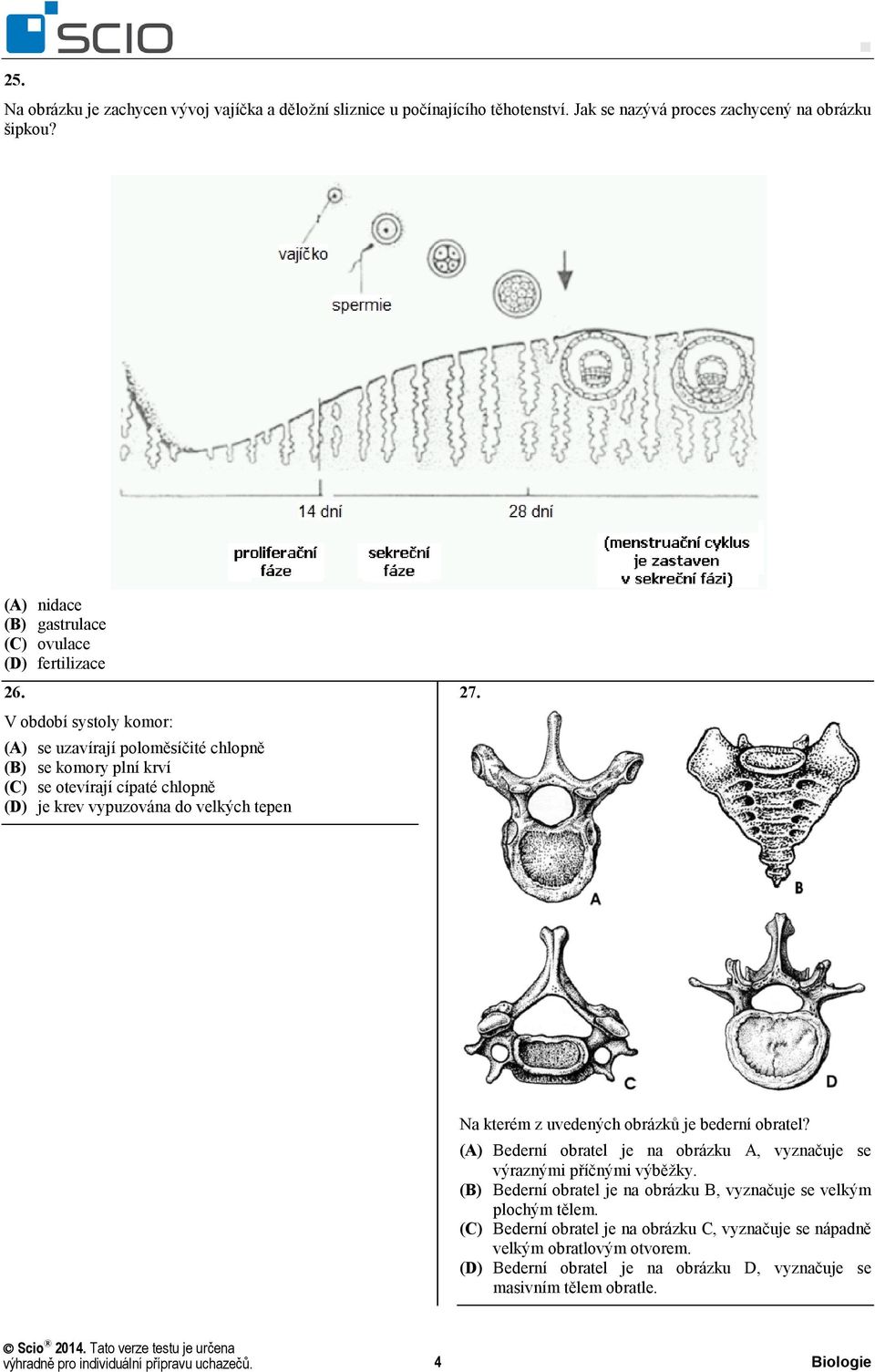 V období systoly komor: (A) se uzavírají poloměsíčité chlopně (B) se komory plní krví (C) se otevírají cípaté chlopně (D) je krev vypuzována do velkých tepen 27.