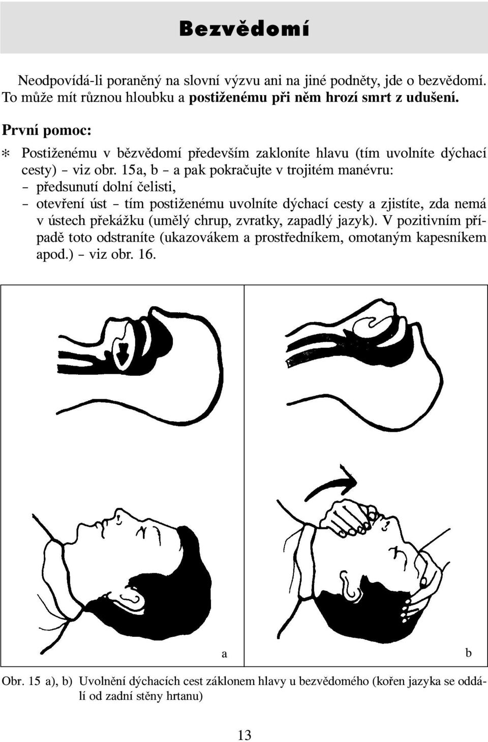 15a, b a pak pokračujte v trojitém manévru: předsunutí dolní čelisti, otevření úst tím postiženému uvolníte dýchací cesty a zjistíte, zda nemá v ústech překážku (umělý