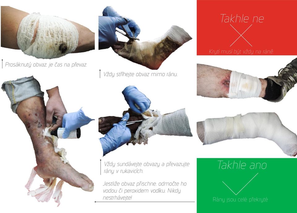Vždy sundávejte obvazy a převazujte rány v rukavicích.