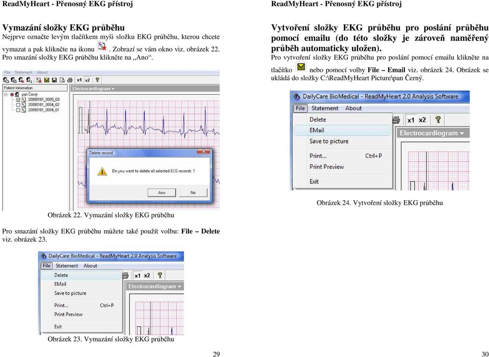 Pro vytvoření složky EKG průběhu pro poslání pomocí emailu klikněte na tlačítko nebo pomocí volby File Email viz. obrázek 24.