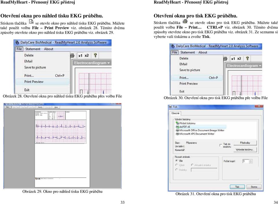 Můžete také použít volbu File Print CTRL+P viz. obrázek 30. Těmito dvěma způsoby otevřete okno pro tisk EKG průběhu viz. obrázek 31. Ze seznamu si vyberte vaši tiskárnu a zvolte Tisk.