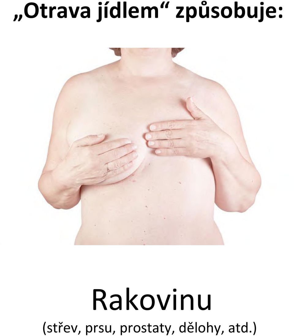 Rakovinu (střev,