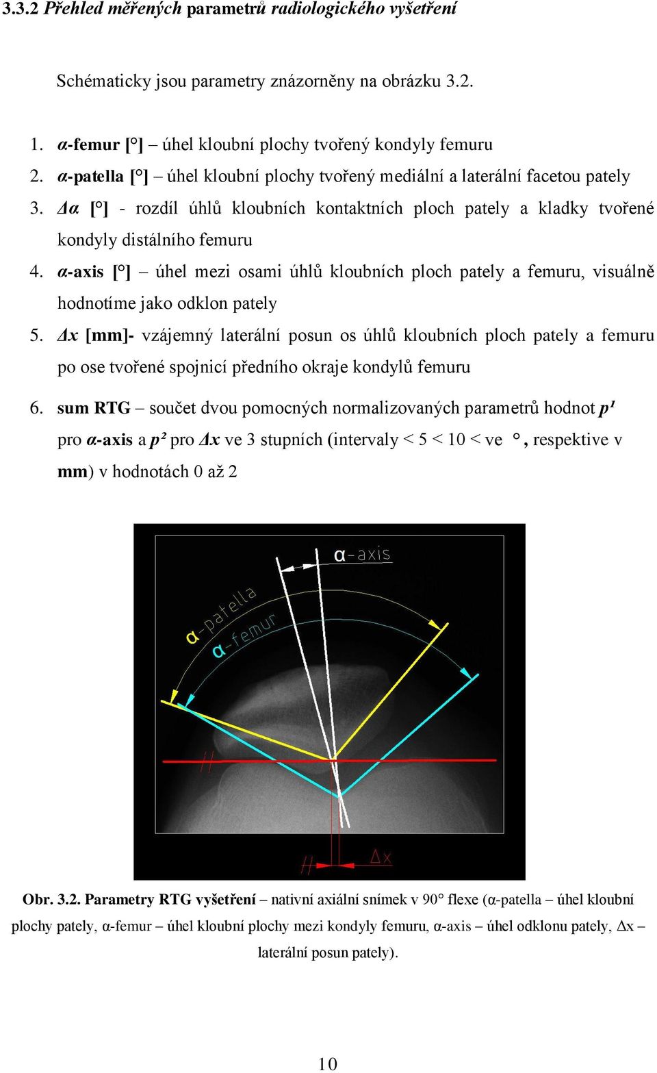 α-axis [ ] úhel mezi osami úhlů kloubních ploch pately a femuru, visuálně hodnotíme jako odklon pately 5.