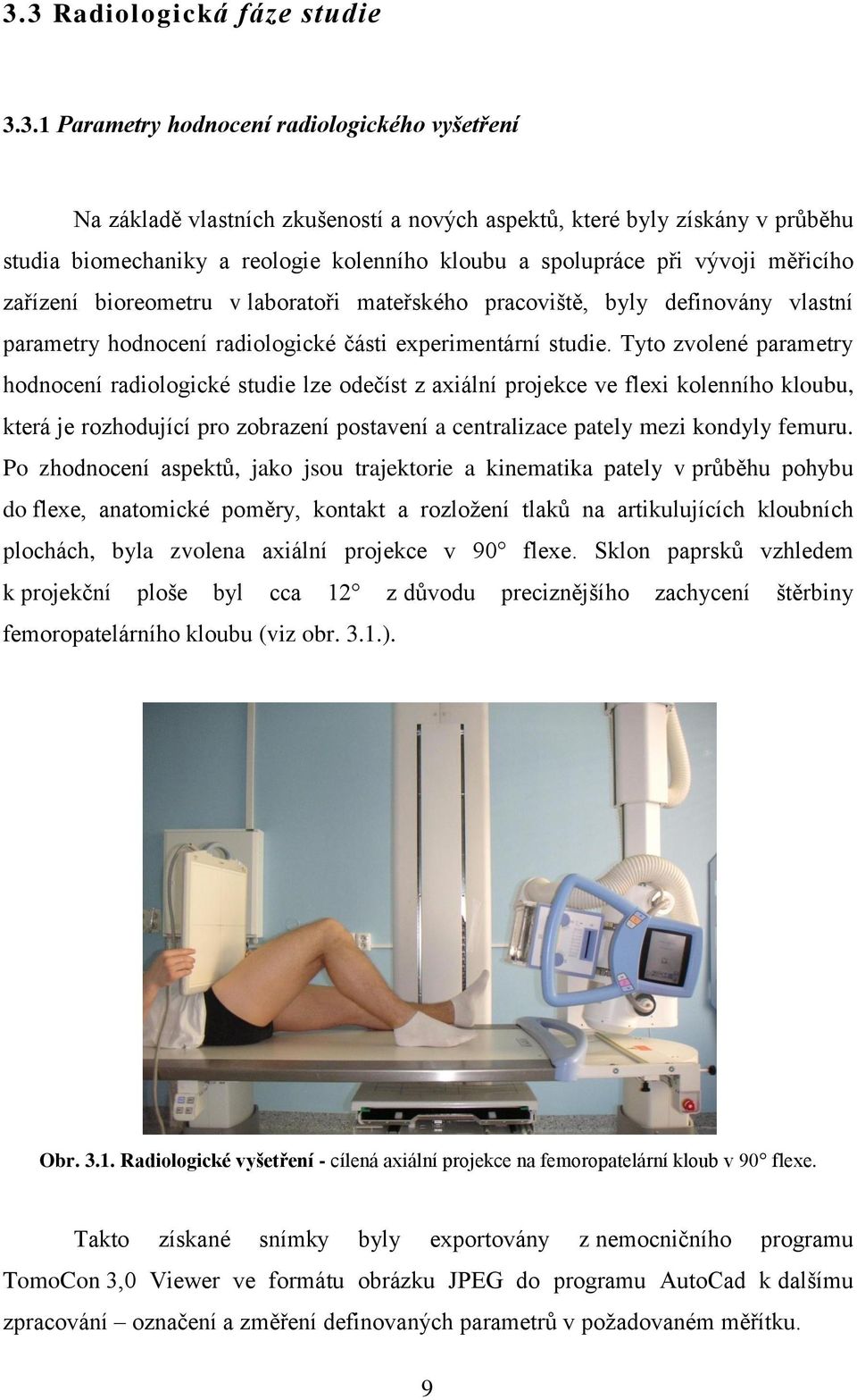 Tyto zvolené parametry hodnocení radiologické studie lze odečíst z axiální projekce ve flexi kolenního kloubu, která je rozhodující pro zobrazení postavení a centralizace pately mezi kondyly femuru.