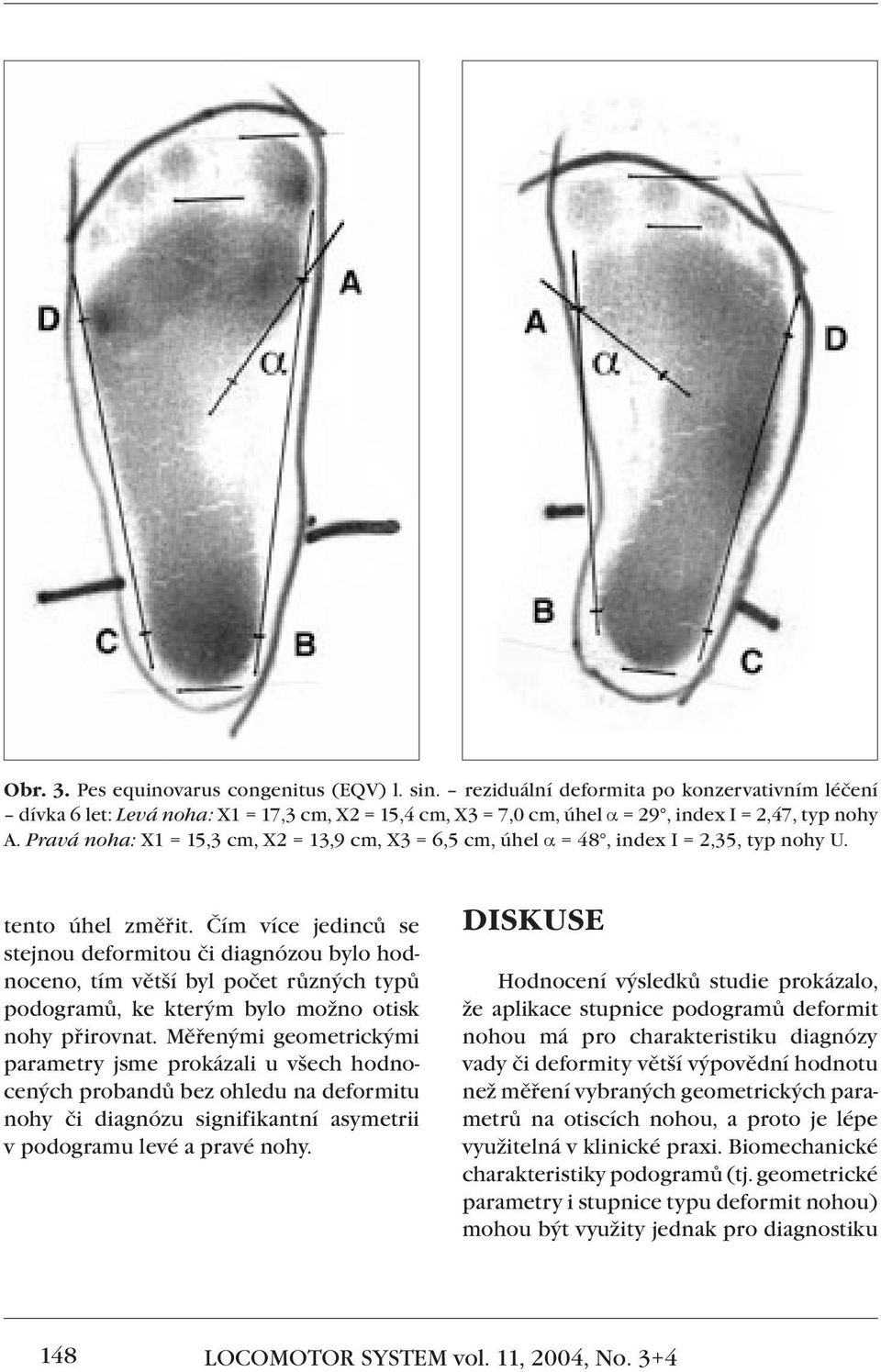 Čím více jedinců se stejnou deformitou či diagnózou bylo hodnoceno, tím větší byl počet různých typů podogramů, ke kterým bylo možno otisk nohy přirovnat.