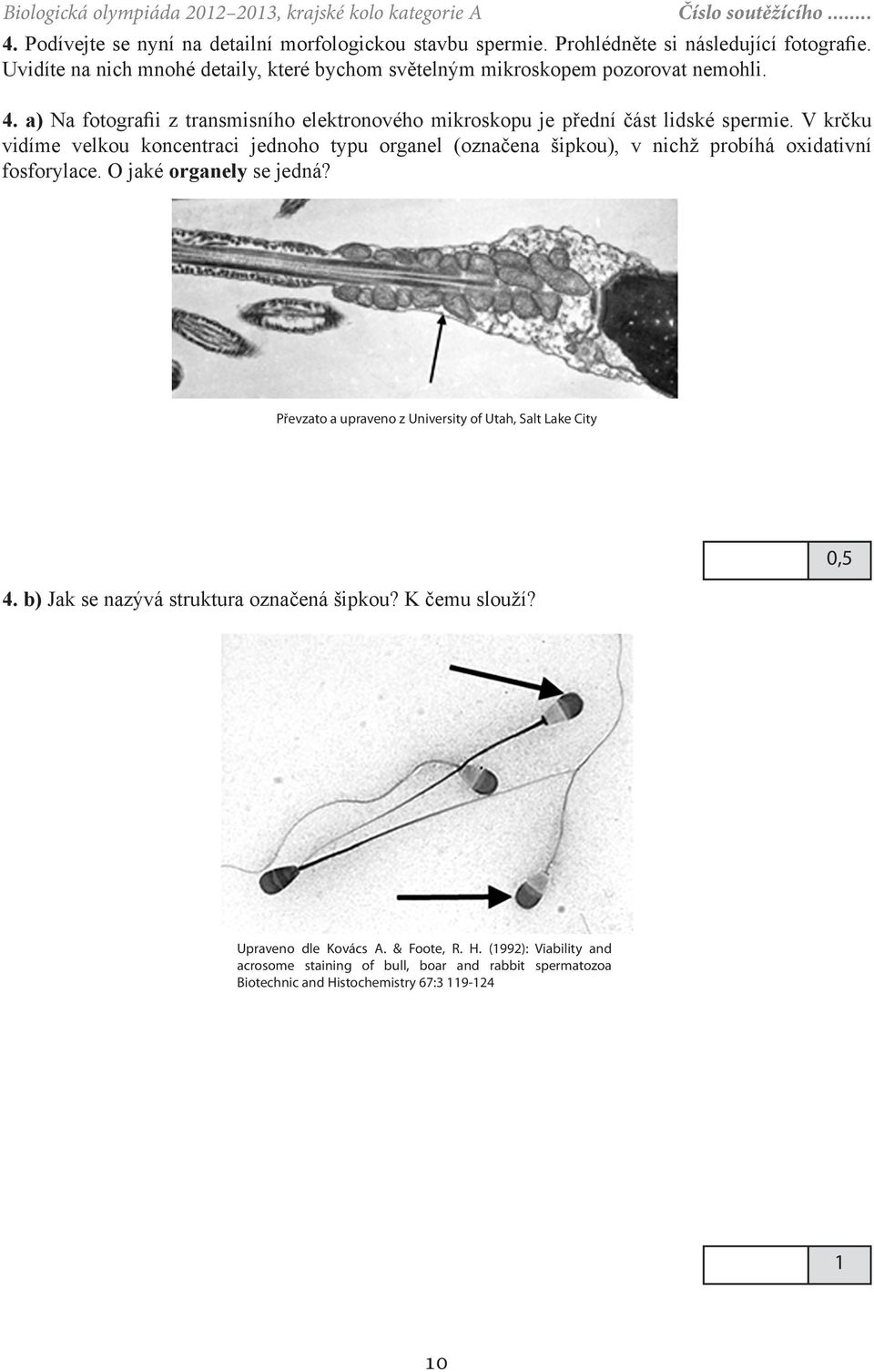 V krčku vidíme velkou koncentraci jednoho typu organel (označena šipkou), v nichž probíhá oxidativní fosforylace. O jaké organely se jedná?