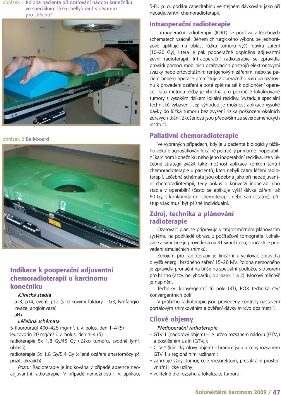 bolus, den 1 4 (5) leucovorin 20 mg/m 2 i. v. bolus, den 1 4 (5) radioterapie 5x 1,8 Gy/45 Gy (lůžko tumoru, svodné lymf. oblasti) radioterapie 5x 1,8 Gy/5,4 Gy (cílené ozáření anastomózy při pozit.