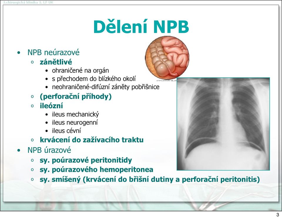 ileus neurgenní ileus cévní krvácení d zažívacíh traktu NPB úrazvé sy.