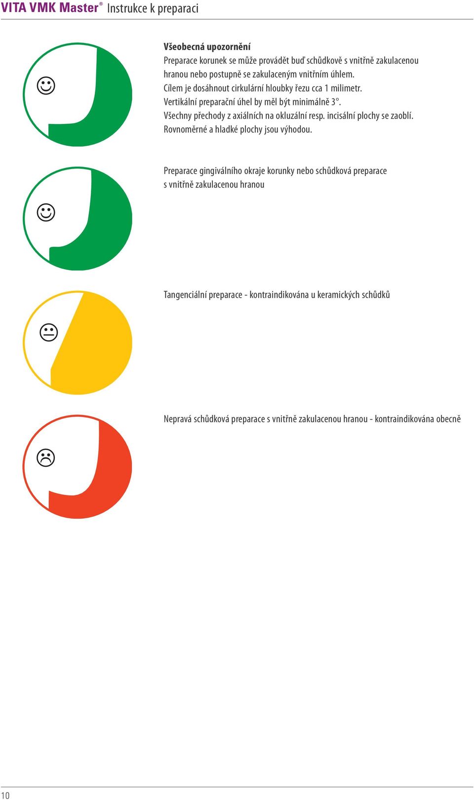 Všechny přechody z axiálních na okluzální resp. incisální plochy se zaoblí. Rovnoměrné a hladké plochy jsou výhodou.