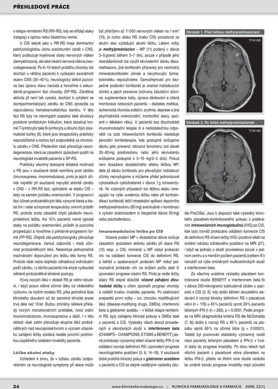 (neurodegenerace).