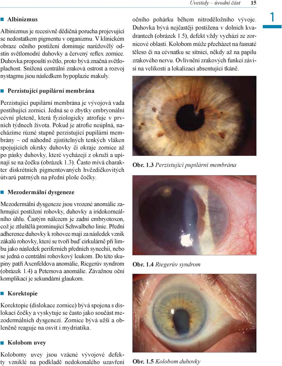 Snížená centrální zraková ostrost a rozvoj nystagmu jsou následkem hypoplazie makuly. Perzistující pupilární membrána Perzistující pupilární membrána je vývojová vada postihující zornici.