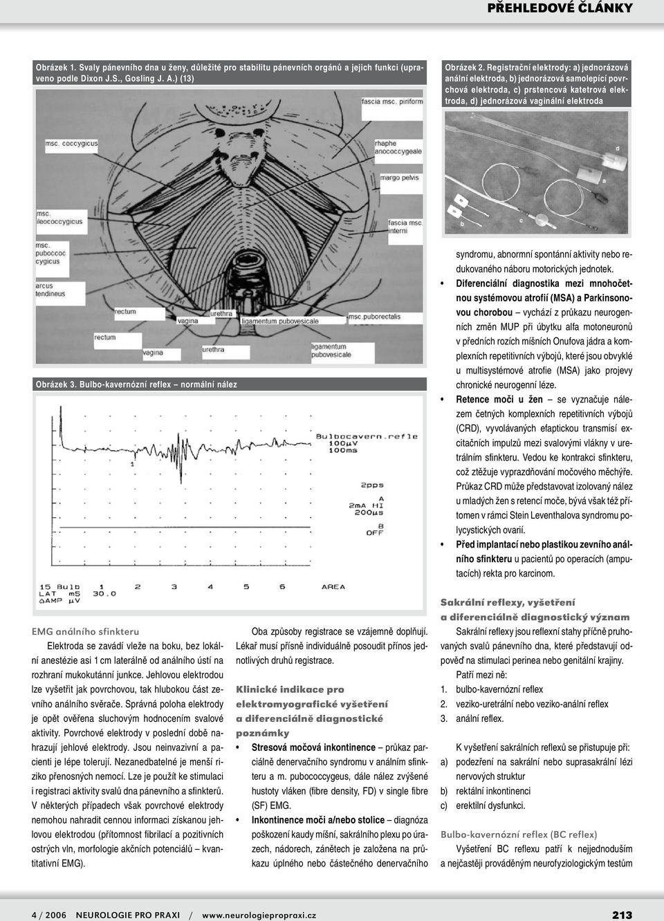 Bulbo-kavernózní reflex normální nález syndromu, abnormní spontánní aktivity nebo redukovaného náboru motorických jednotek.