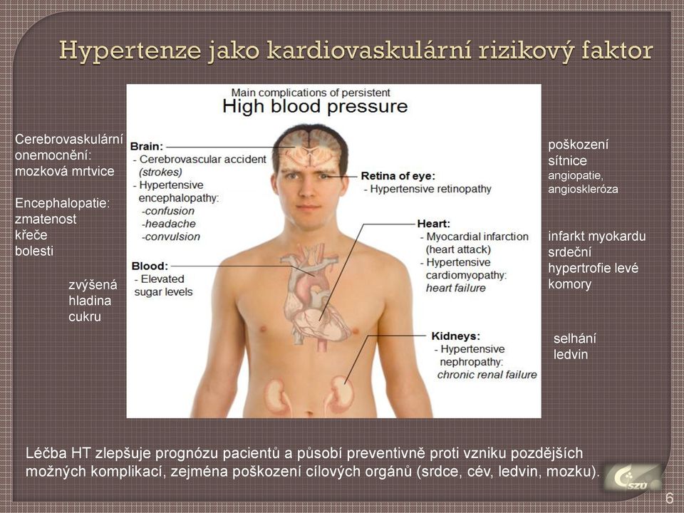 levé komory selhání ledvin Léčba HT zlepšuje prognózu pacientů a působí preventivně proti