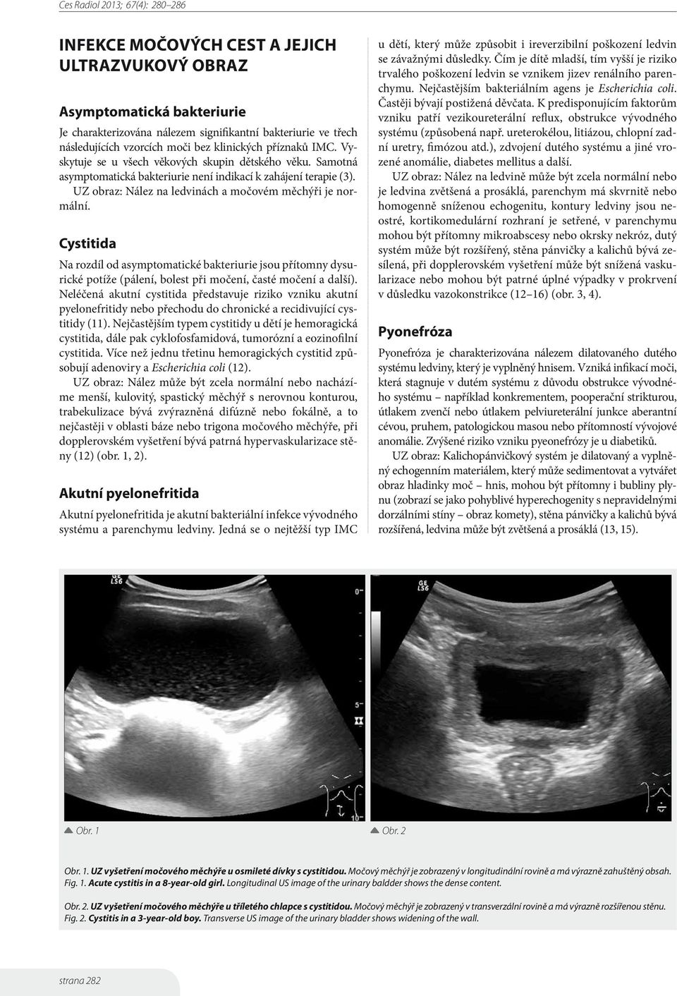 Cystitida Na rozdíl od asymptomatické bakteriurie jsou přítomny dysurické potíže (pálení, bolest při močení, časté močení a další).