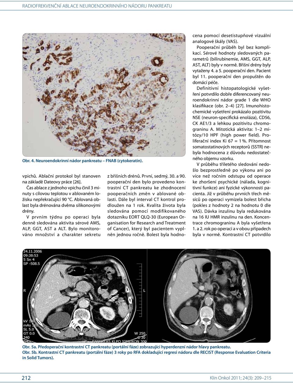 Kvalita života byla sledována pomocí modifikovaného dotazníku EORT QLQ-30 (European Organisation for Research and Treatment of Cancer), který byl pacientem vyplněn jednou ročně.