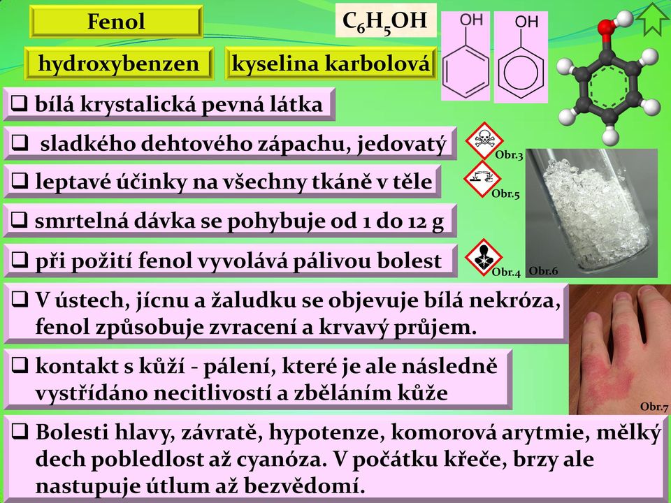 necitlivostí a zběláním kůže Obr.3 Obr.6 V ústech, jícnu a žaludku se objevuje bílá nekróza, fenol způsobuje zvracení a krvavý průjem.